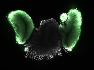 Day11_Optic-cup_DAPI_GFP_Lucie-Zilova_4zu3_klein